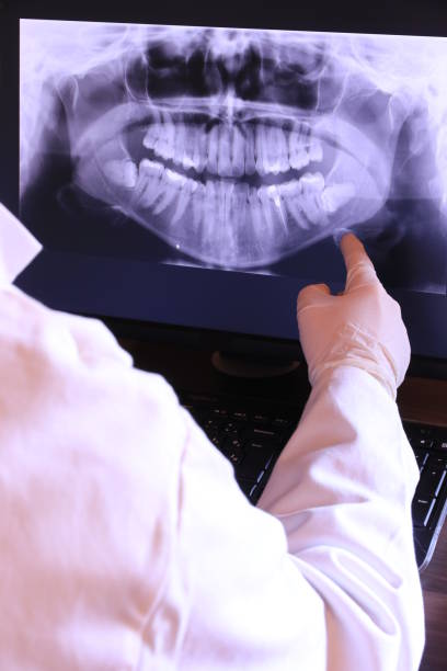 Best Emergency Wisdom Teeth Removal in St Charles, MN